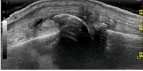 RhMSUS Question 26